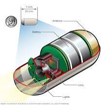 Capsule endoscopy - Mayo Clinic