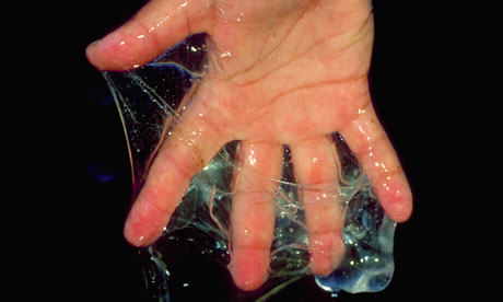 Hand-covered-with-hagfish-008.jpg